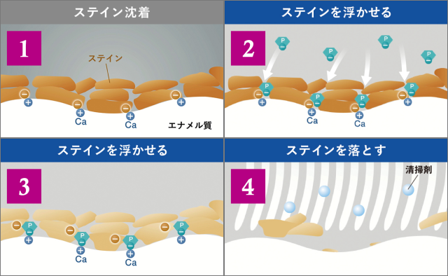 歯を白くする効果アリ|着色予防効果も?