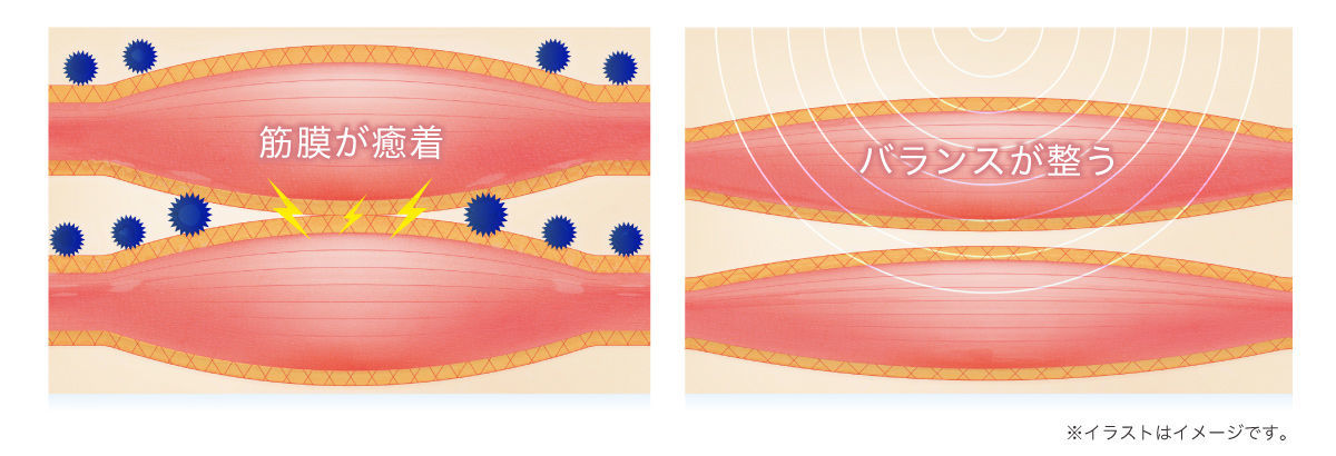 筋膜リリースが簡単にできる｜疲労に対する効果が高い