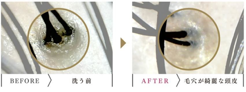 f:id:sk96a:20201022234011j:plain 抜け毛への影響